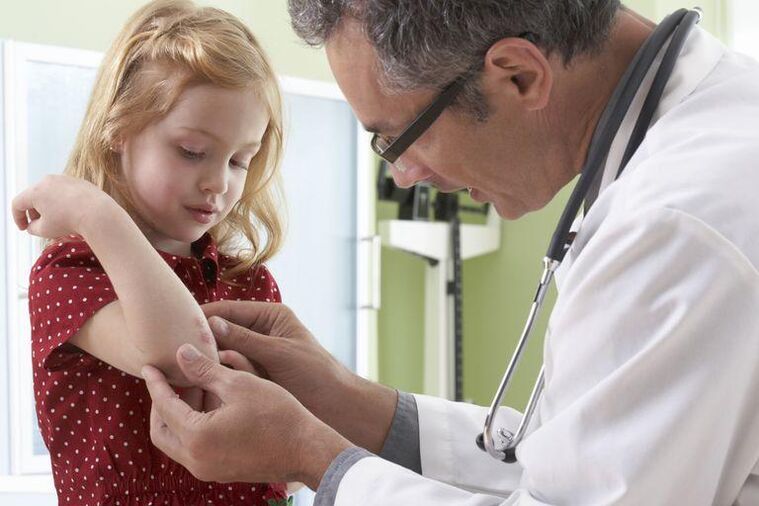 a doctor examines a child with psoriasis